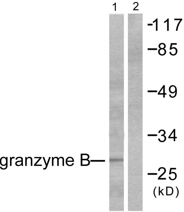 GZMB / Granzyme B Antibody