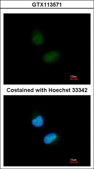 NR1H2 / LXR Beta Antibody