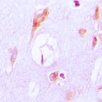 Polyclonal Rabbit anti-Human CYP27 / CYP27A1 Antibody (Internal, IHC, IF, WB)