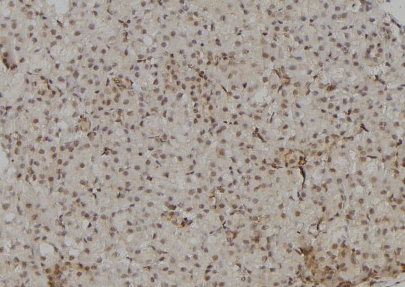 POLR2A / RNA polymerase II Antibody