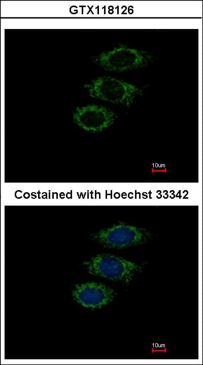 PPIL1 Antibody