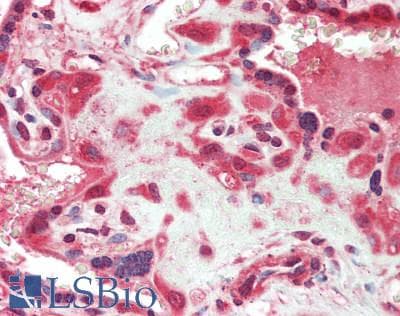 IHC-plus™ ANGPTL2 / ARP2 Antibody (aa23-493)