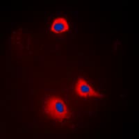 SYT1 / Synaptotagmin Antibody (Internal)
