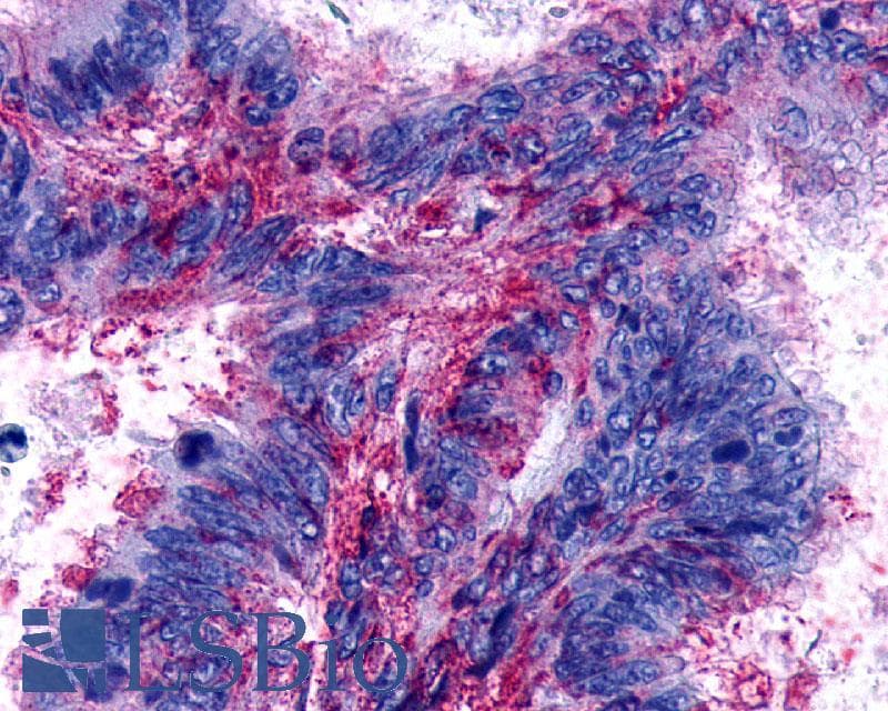 PathPlus™ Polyclonal Rabbit anti-Human LPAR3 / LPA3 / EDG7 Antibody (Cytoplasmic Domain, IHC)