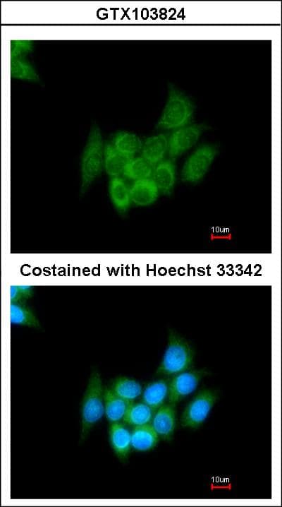 AGT / Angiotensinogen Antibody (aa1-476)
