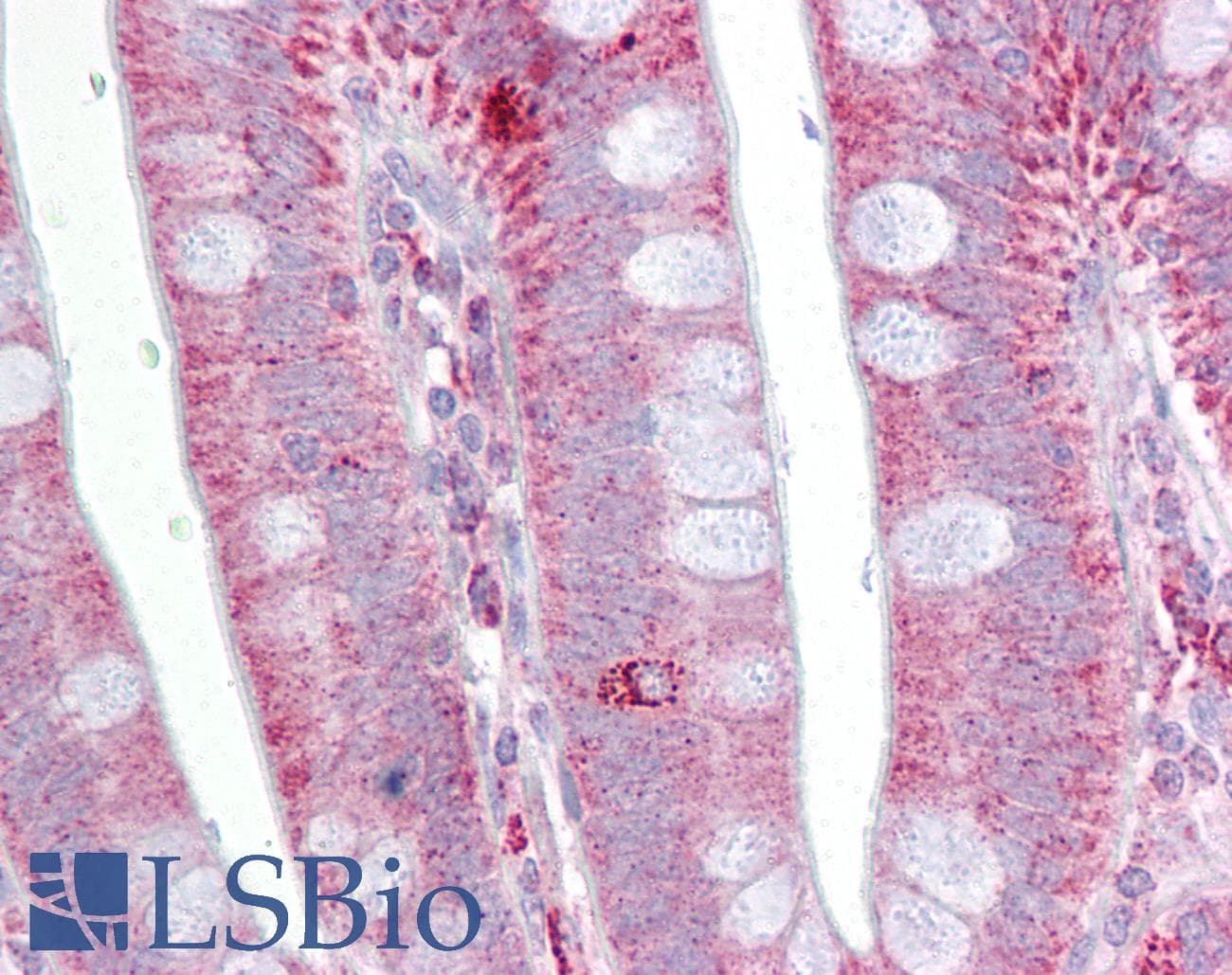 POSTN / Periostin Antibody (aa251-300)