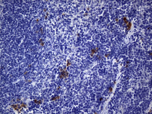 CD74 / CLIP Antibody (clone UMAB231)