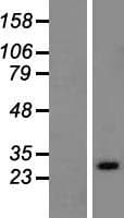 RAB33A Protein (Over-Expression Lysate Myc-DDK (Flag))
