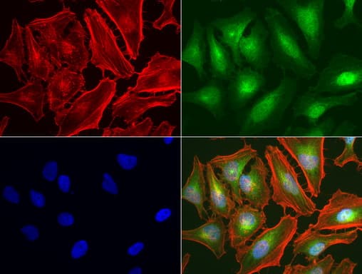 c-Met Antibody (aa570-885, clone UMAB190)