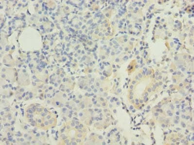 IHC-plus™ RAP1A Antibody