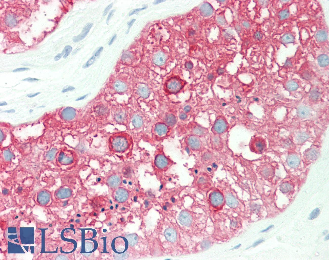 IHC-plus™ TUBA8 / Tubulin Alpha 8 Antibody (clone 2D6)