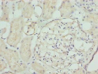 Polyclonal Rabbit anti-Human NFAM1 Antibody (IHC)