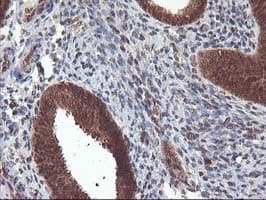 Monoclonal Mouse anti-Human LCMT1 Antibody (clone OTI2C9, IHC, WB)