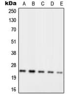 RPL10 / Ribosomal Protein L10 Antibody (Internal)