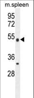 Polyclonal Rabbit anti-Human METTL4 Antibody (aa315-344, IHC, WB)