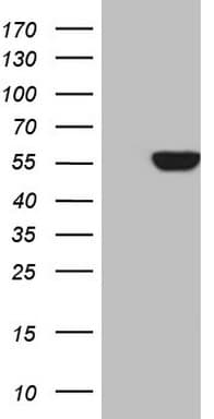 PALS2 / MPP6 Antibody (clone OTI3H5)