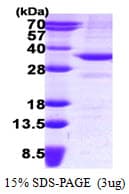 Human SDR9C1 / BDH1 Protein (Recombinant His)