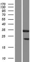 SHBG Protein (Over-Expression Lysate Myc-DDK (Flag))