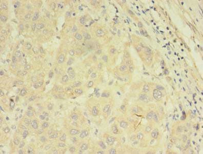 Polyclonal Rabbit anti-Human ABCB5 Antibody (IHC)