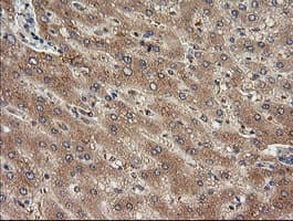 Monoclonal Mouse anti-Human TRIM38 Antibody (clone OTI1D6, IHC, WB)