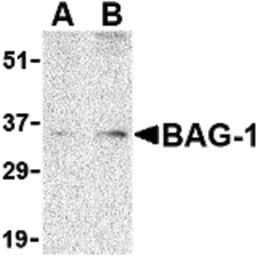 IHC-plus™ Polyclonal Rabbit anti-Human BAG1 / BAG-1 Antibody (IHC, IF, WB)