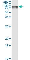 Monoclonal Mouse anti-Human GLB1 / Beta-Galactosidase Antibody (clone 6E7, WB)