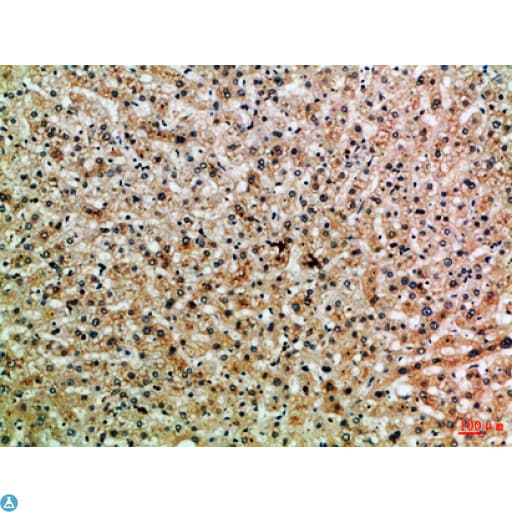 PPP1R13B Antibody
