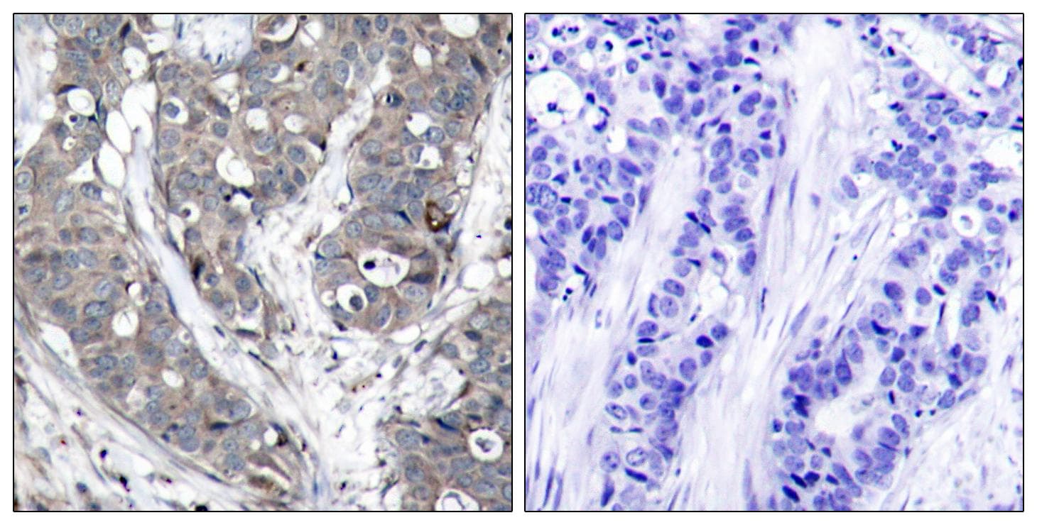 HSPB1 / HSP27 Antibody (p78)
