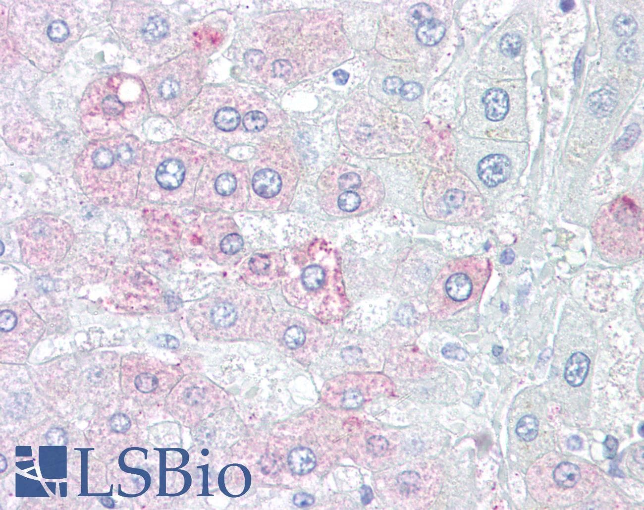 IHC-plus™ c-Met Antibody (clone 4AT44)