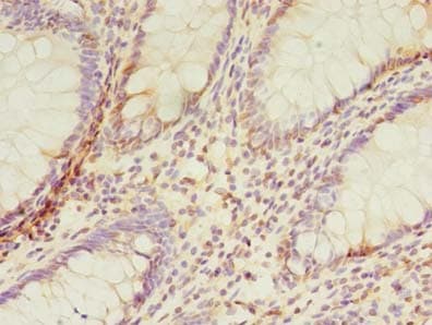 TMEM165 Antibody