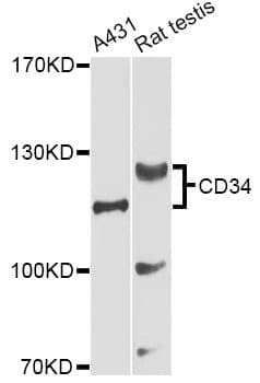 IHC-plus™ Polyclonal Rabbit anti-Human CD34 Antibody (IHC, IF, WB)