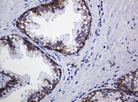 CDH1 / E Cadherin Antibody (clone OTI3E2)