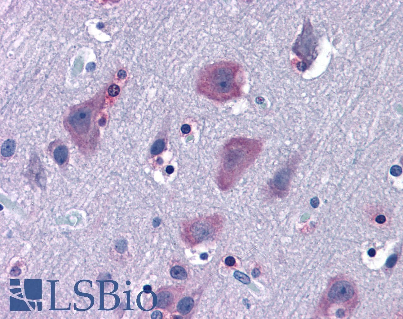 IHC-plus™ KIAA0517 / TRIM2 Antibody (aa758-771)