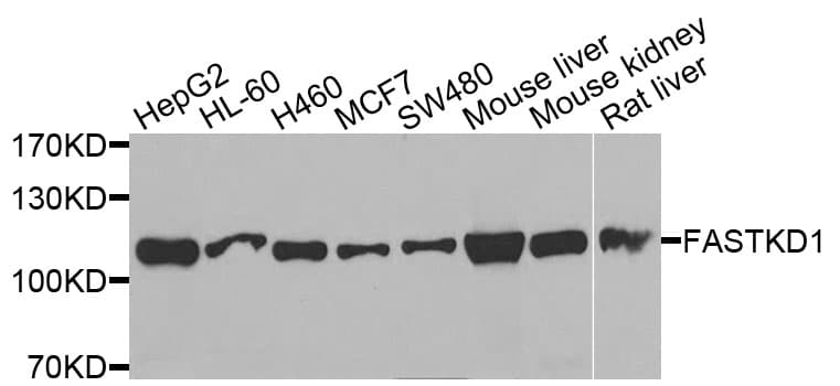 Polyclonal Rabbit anti-Human FASTKD1 Antibody (IHC, WB)