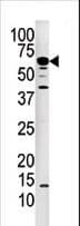 IHC-plus™ PPP3CA / CCN1 / Calcineurin A Antibody (aa21-51)