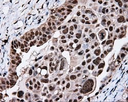 Monoclonal Mouse anti-Human TLDC1 / KIAA1609 Antibody (clone OTI5D9, IHC, IF, WB)
