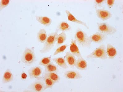 HIST1H2BN Antibody