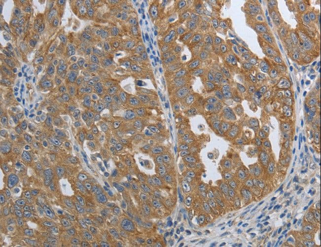 PTPRM / PTP Mu Antibody