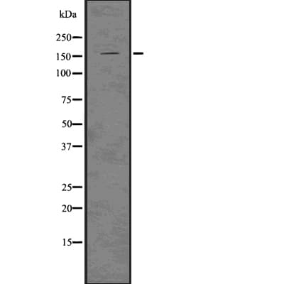LATS1 Antibody