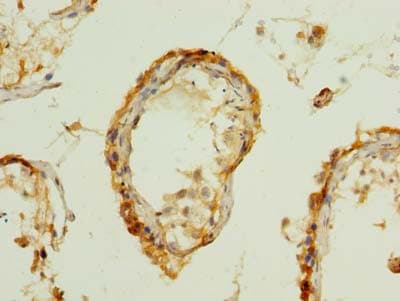 PDIA5 / PDIR Antibody