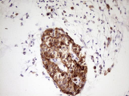 Monoclonal Mouse anti-Human NTRK1 / TrkA Antibody (clone OTI5B6, aa440-796, IHC, WB)
