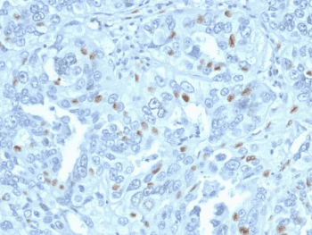 CCNA2 / Cyclin A2 Antibody (clone CCNA2/2333)