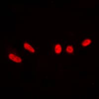 Polyclonal Rabbit anti-Human PRKDC / DNA-PKcs Antibody (phospho-Thr2647, IHC, IF, WB)