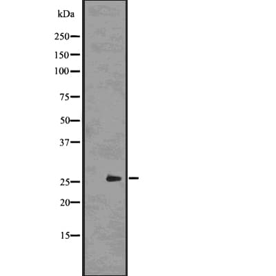 UCHL3 Antibody