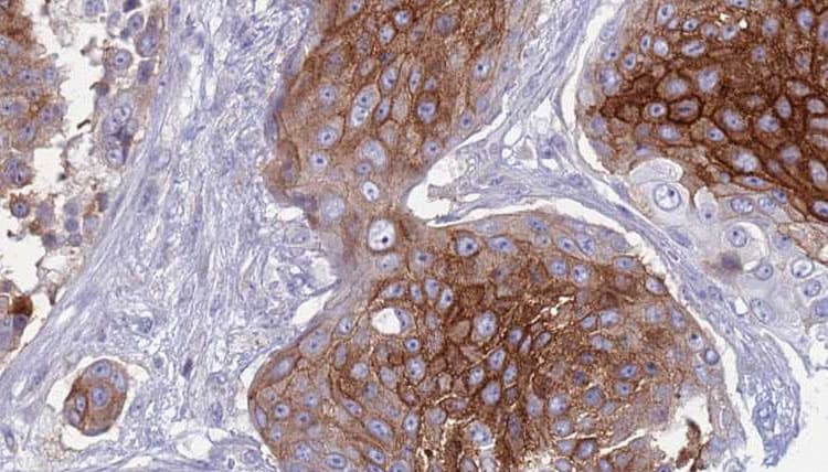 SLC1A4 / ASCT1 Antibody