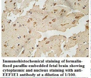 EEF1E1 / AIMP3 Antibody (aa1-174)