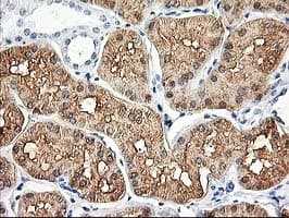 ALDOB Antibody (clone OTI3E10)
