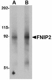 IHC-plus™ Polyclonal Rabbit anti-Human FNIP2 Antibody (IHC, WB)