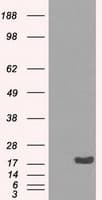Monoclonal Mouse anti-Human CRYAB / Alpha B Crystallin Antibody (clone OTI2A1, IHC, IF, WB)
