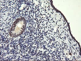 SOLO / SESTD1 Antibody (clone OTI2E7)